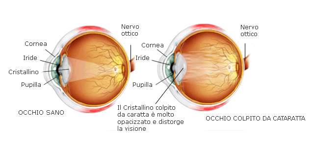 patologie oculari